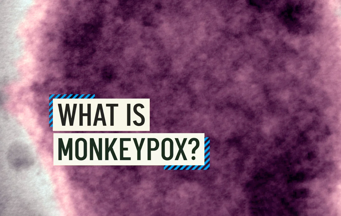 Everything You Need To Know About the Monkeypox Virus