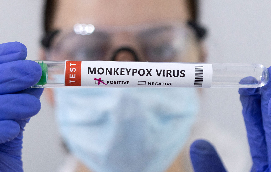 Disease Control Department: No Higher Alert on Monkeypox