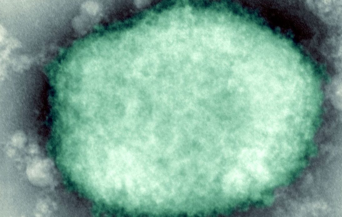 Govt To Consider Highest Alert Level Over Monkeypox