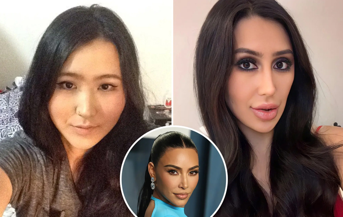 Woman Spends ,000 on Surgeries To Look Like Kim Kardashian